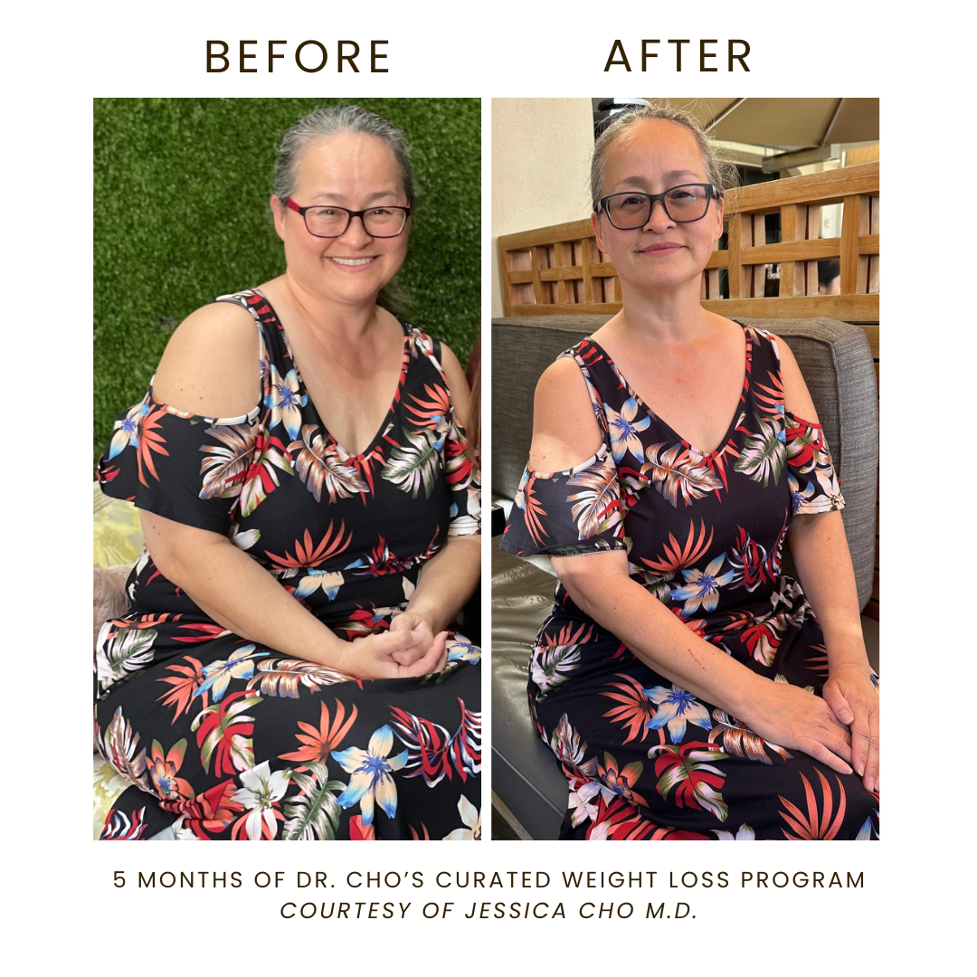 medical weight loss patient